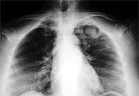 Telemedicina não funciona