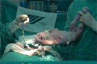 Maternidade com fim à vista