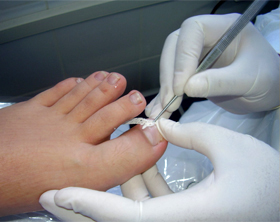 Junta reforça cuidados de saúde em Vale das Fontes