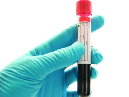 Bloco questiona ministro da Saúde sobre atraso no pagamento aos Laboratórios