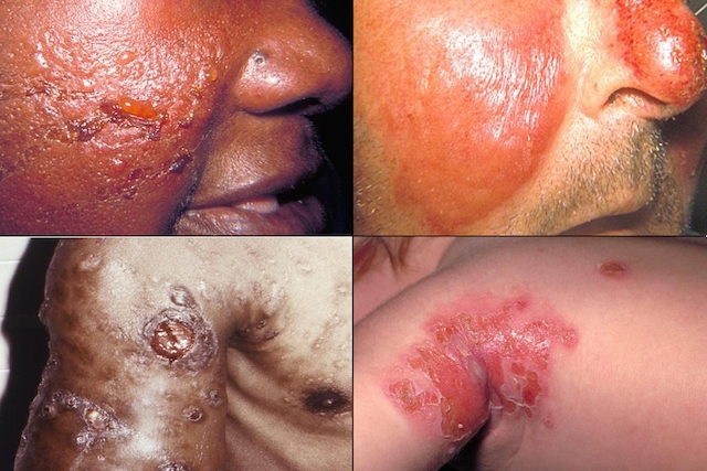 Talhar o bicho e benzer o coxo