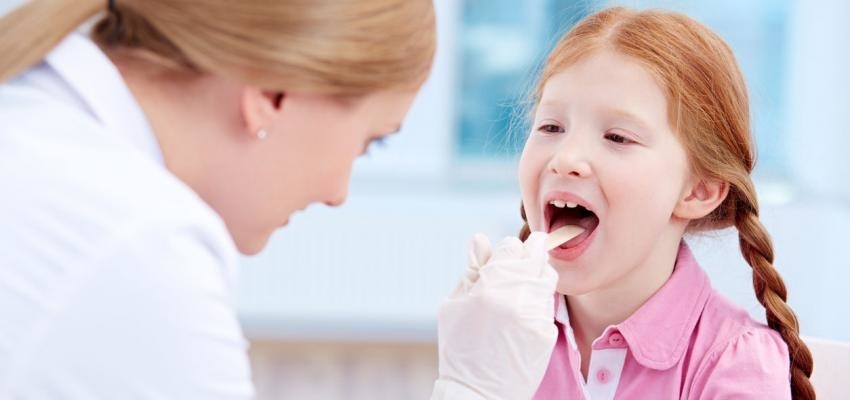 Amigdalite: conselhos para prevenir e tratar a doença