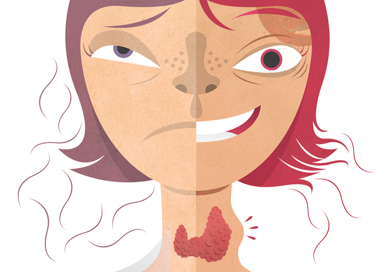 Hipertiroidismo e hipotiroidismo