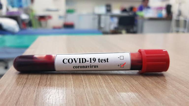 24 pessoas infectadas com a Covid-19 no distrito de Bragança