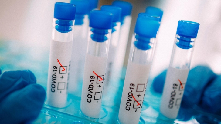 Funcionários das creches do distrito com testes negativos para Covid-19