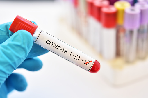 Covid-19: dez pacientes recuperados e três novos casos no distrito