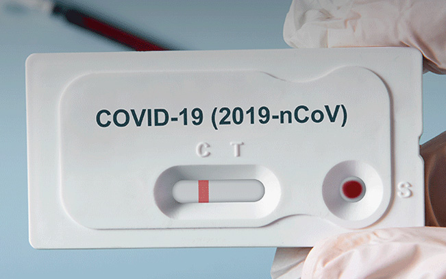 Apenas sete farmácias do distrito disponibilizam testes gratuitos