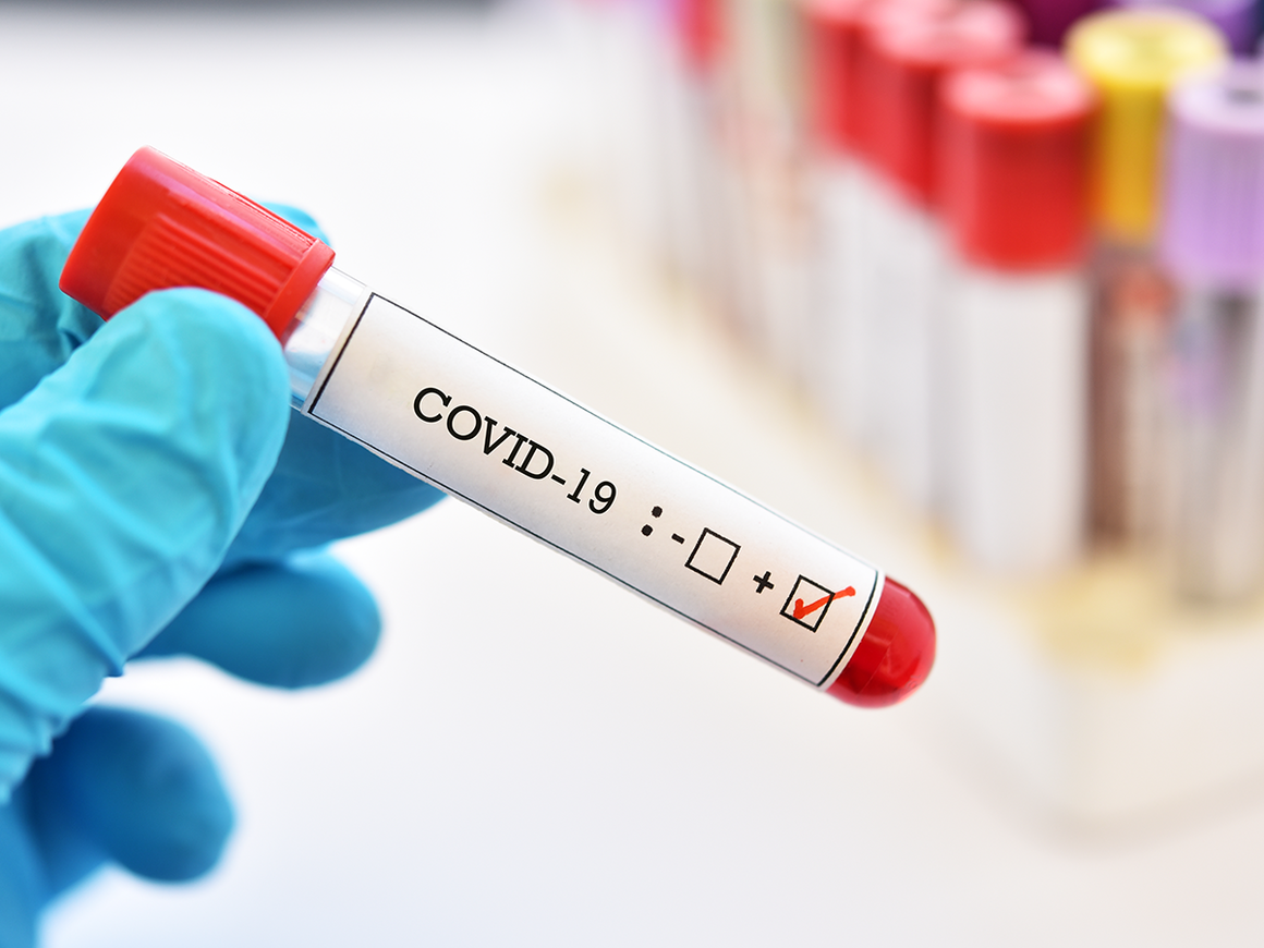 Distrito tem 862 casos activos de covid-19
