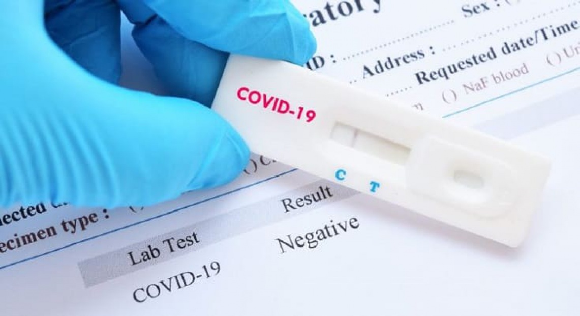 Cruz Vermelha de Bragança realiza testes gratuitos à covid-19