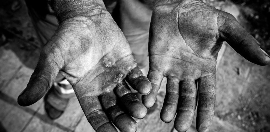 Detidos por escravizarem e maltratarem homem em Bragança ficam em liberdade